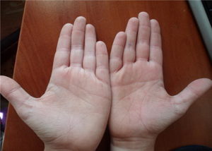 Плотное соединение пальцев