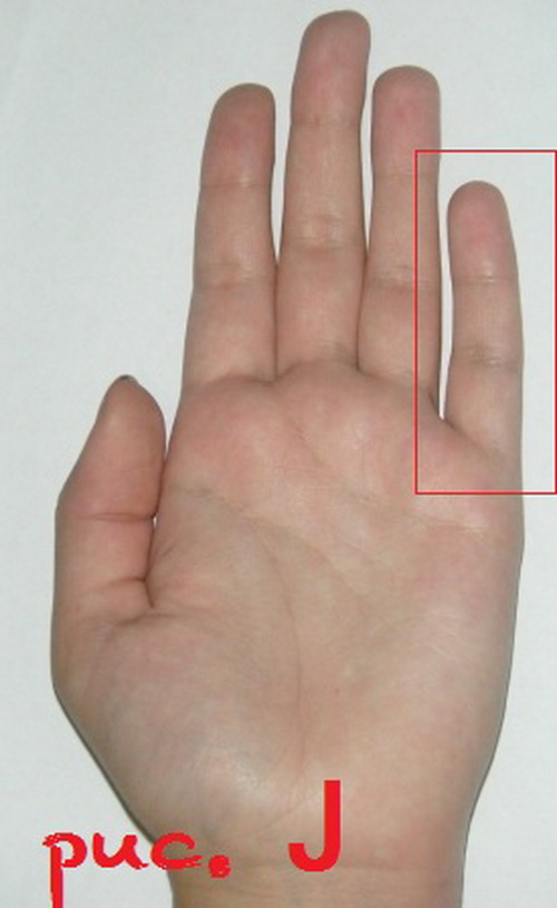 Ковид пальцы. Палец Меркурия хиромантия. Кривой безымянный палец.