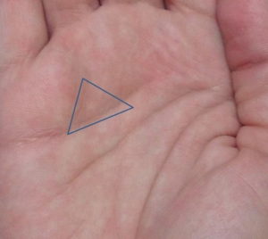Сердечный треугольник